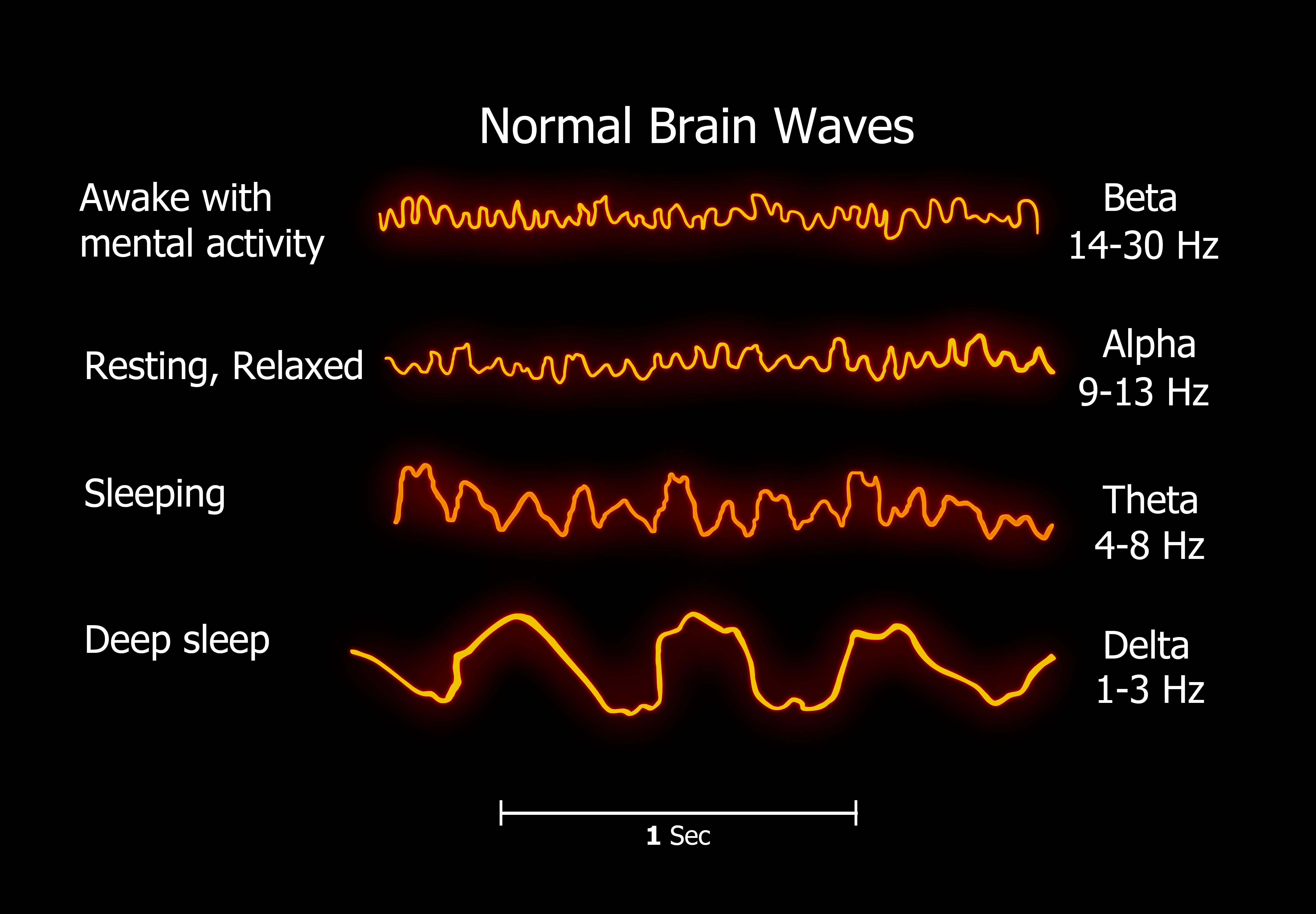 EEG-graphs