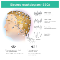 Pic-of-EEG-being-recorded