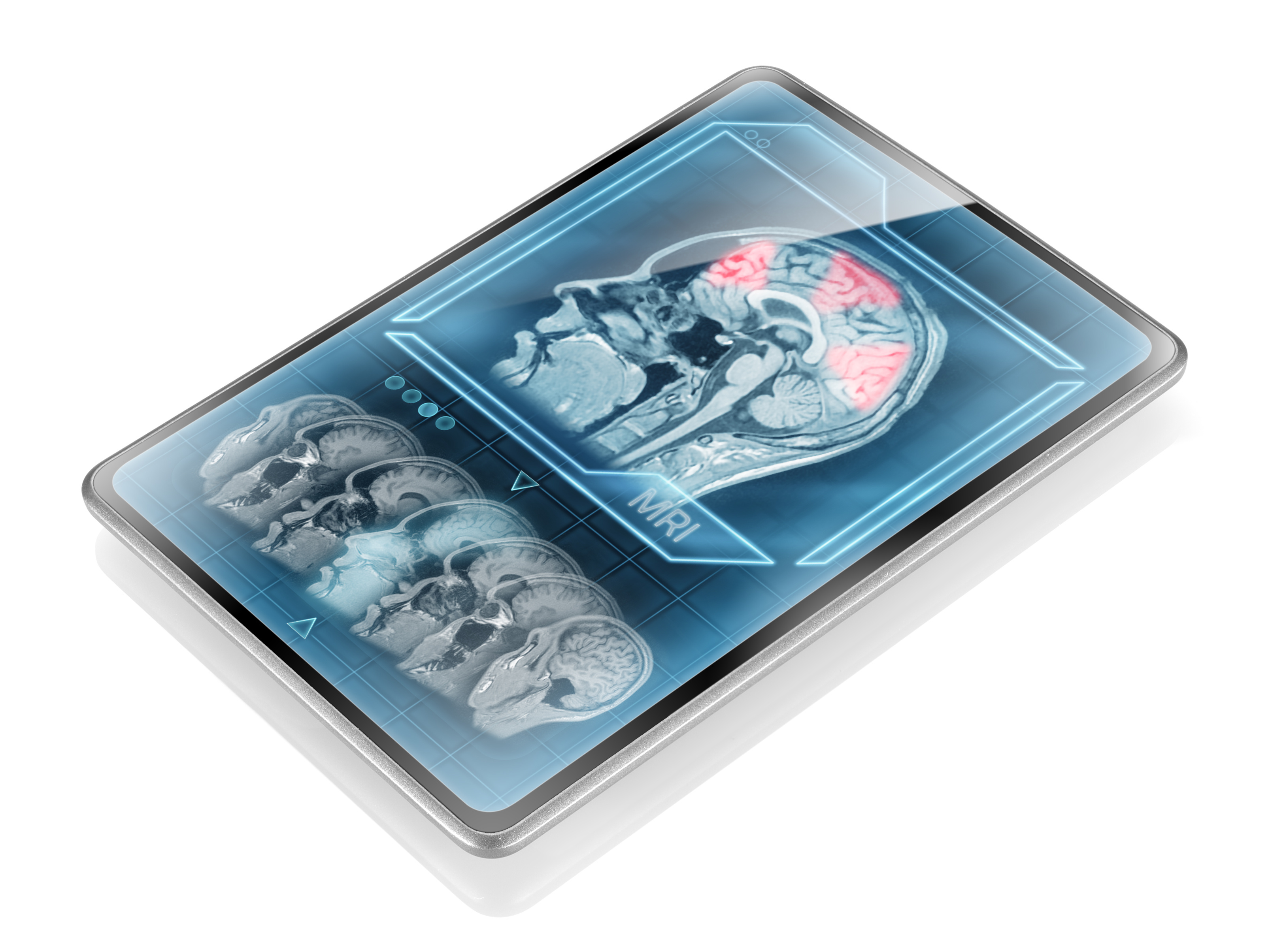 fMRI-image-on-tablet